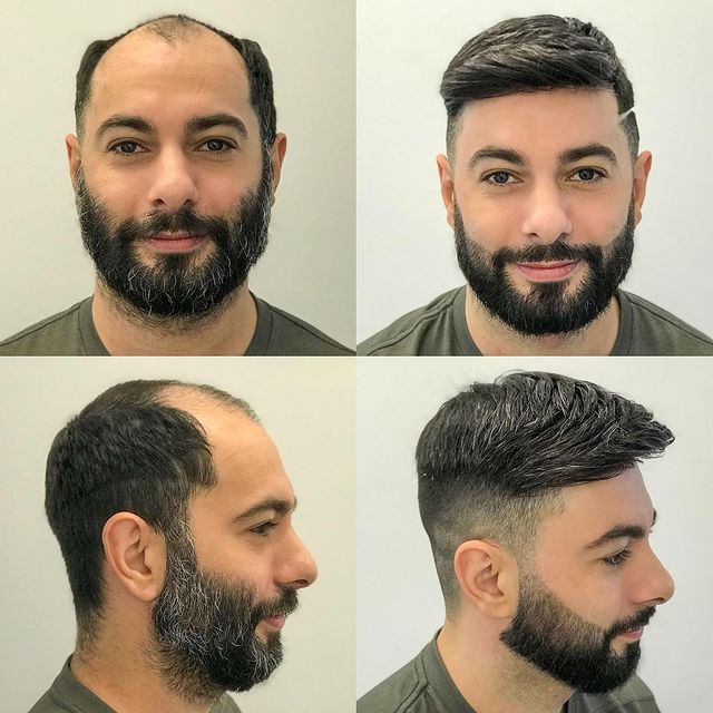 veda hair fixing